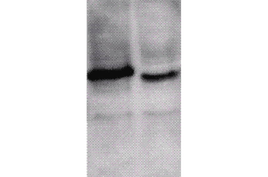 Western Blot - Anti-ING1 Antibody (A304909) - Antibodies.com
