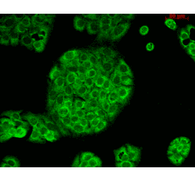 Immunocytochemistry/Immunofluorescence - Anti-CD74 Antibody [PIN.1] (A304910) - Antibodies.com