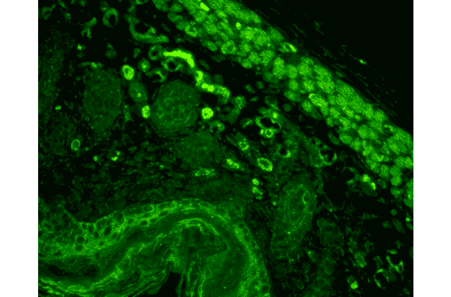 Immunohistochemistry - Anti-CD74 Antibody [PIN.1] (A304910) - Antibodies.com