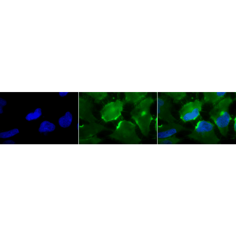 Immunocytochemistry/Immunofluorescence - Anti-CD74 Antibody [PIN.1] (A304910) - Antibodies.com