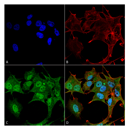 Immunocytochemistry/Immunofluorescence - Anti-ATG4B Antibody (A304912) - Antibodies.com