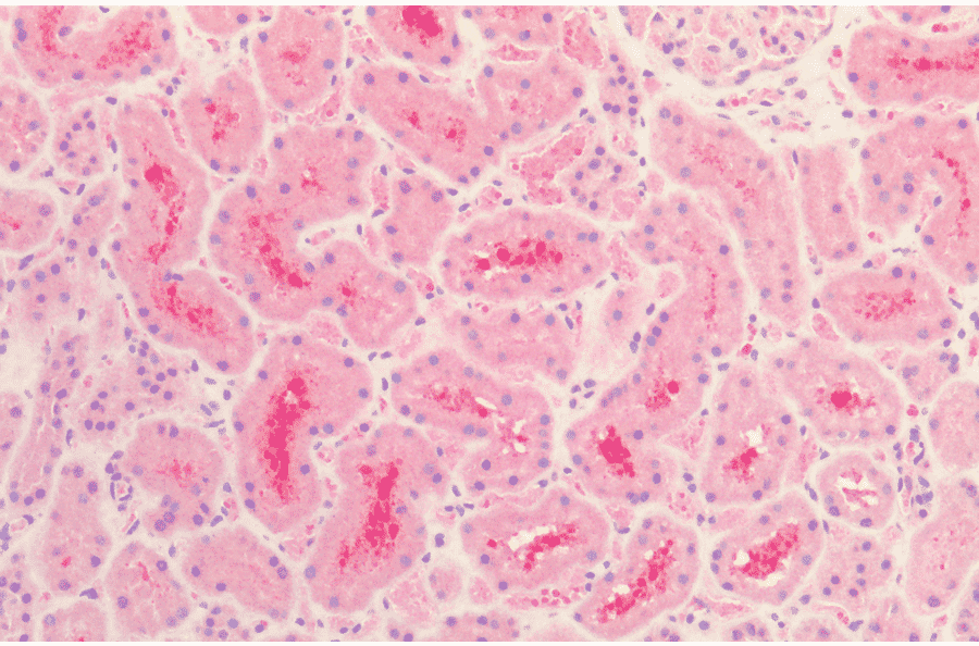 Immunohistochemistry - Anti-Tau Antibody (A304913) - Antibodies.com