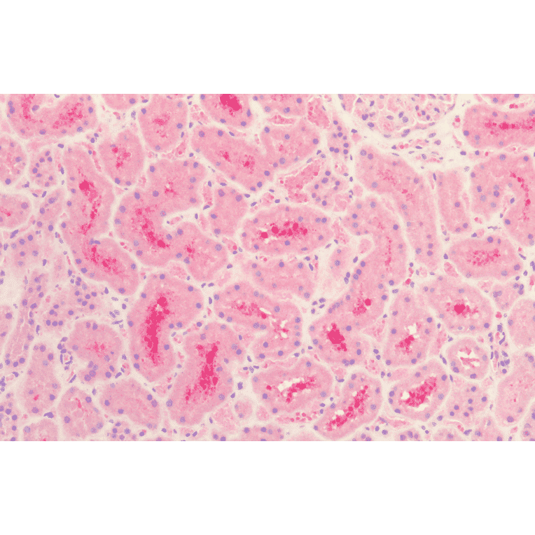 Immunohistochemistry - Anti-Tau Antibody (A304913) - Antibodies.com