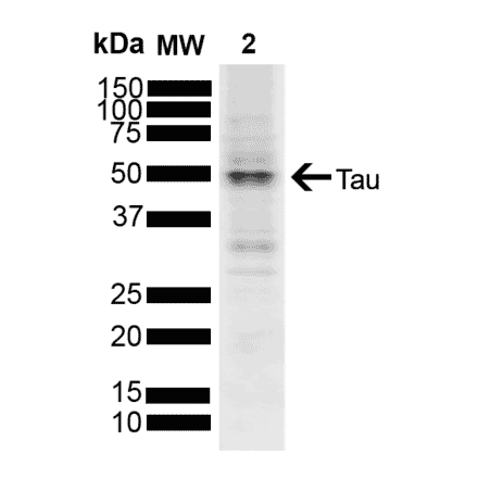 Western Blot - Anti-Tau Antibody (A304914) - Antibodies.com