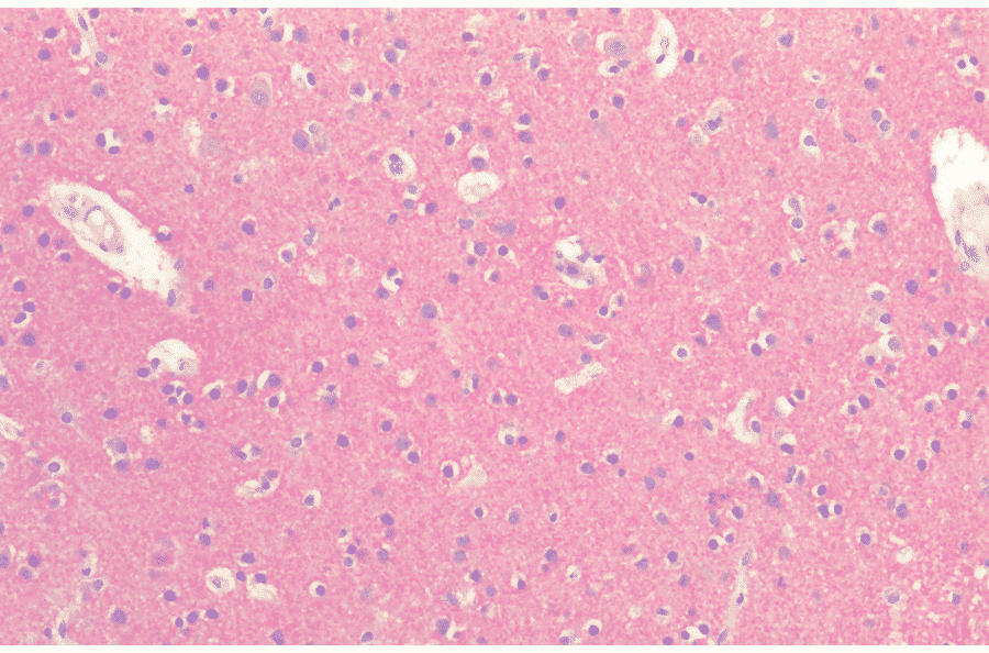 Immunohistochemistry - Anti-Tau Antibody (A304914) - Antibodies.com