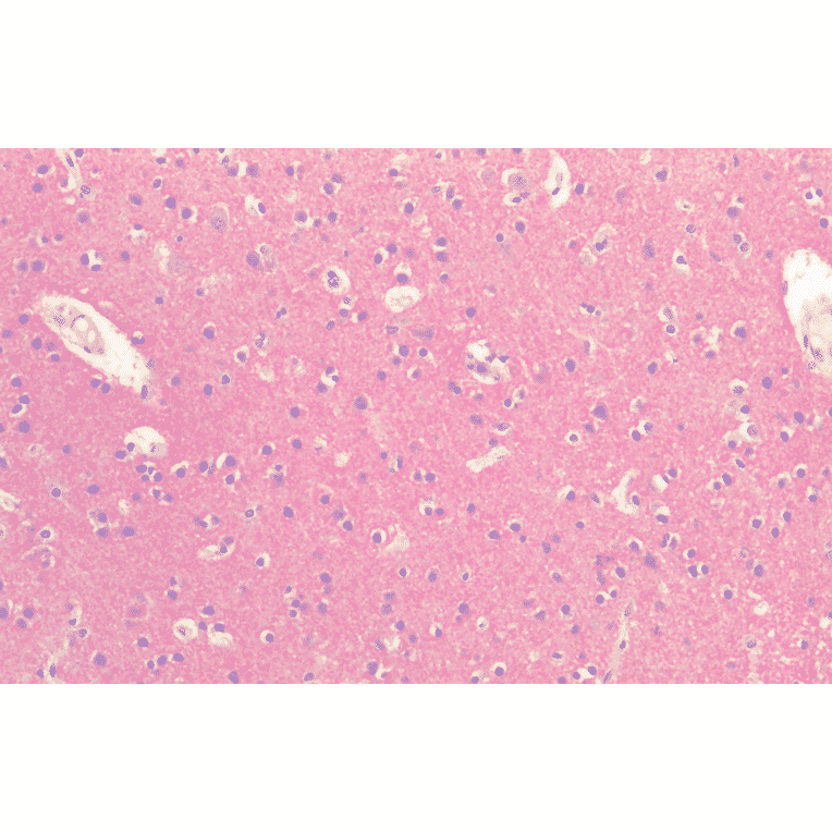 Immunohistochemistry - Anti-Tau Antibody (A304914) - Antibodies.com