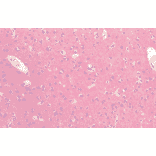 Immunohistochemistry - Anti-Tau Antibody (A304914) - Antibodies.com