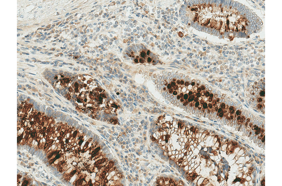 Immunohistochemistry - Anti-RIP3 Antibody (A304917) - Antibodies.com