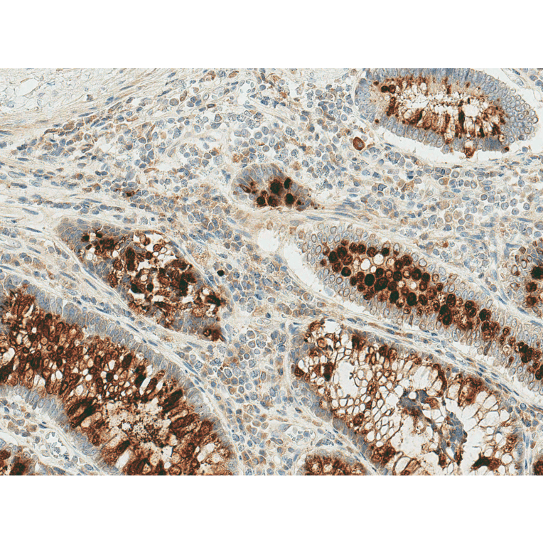 Immunohistochemistry - Anti-RIP3 Antibody (A304917) - Antibodies.com