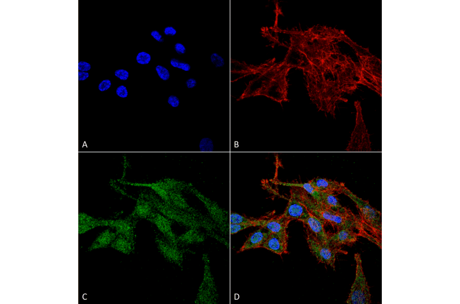 Immunocytochemistry/Immunofluorescence - Anti-RIP3 Antibody (A304917) - Antibodies.com