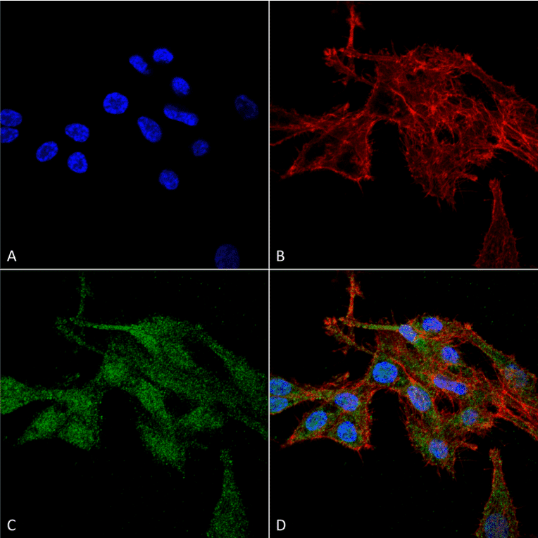 Immunocytochemistry/Immunofluorescence - Anti-RIP3 Antibody (A304917) - Antibodies.com