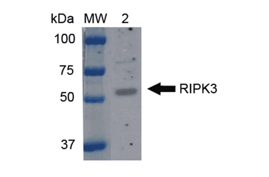 Western Blot - Anti-RIP3 Antibody (A304917) - Antibodies.com