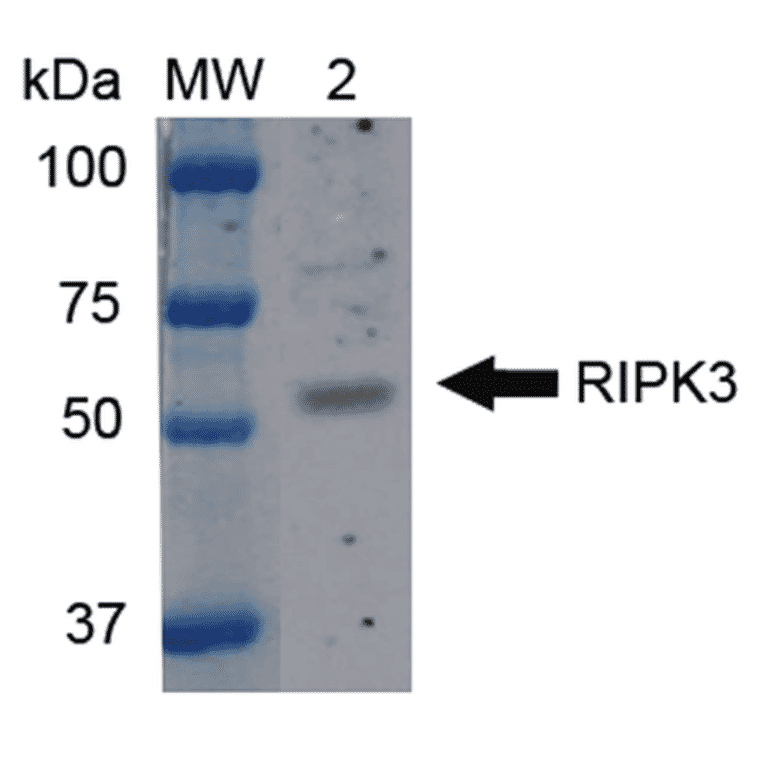 Western Blot - Anti-RIP3 Antibody (A304917) - Antibodies.com