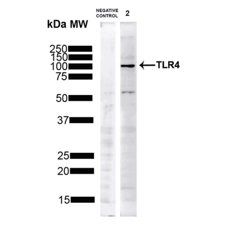 Western Blot - Anti-TLR4 Antibody (A304918) - Antibodies.com