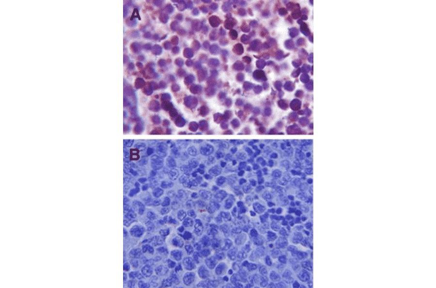 Immunohistochemistry - Anti-TLR4 Antibody (A304918) - Antibodies.com