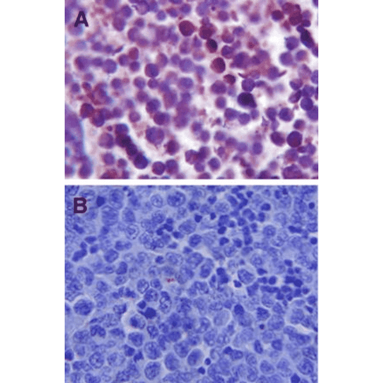 Immunohistochemistry - Anti-TLR4 Antibody (A304918) - Antibodies.com
