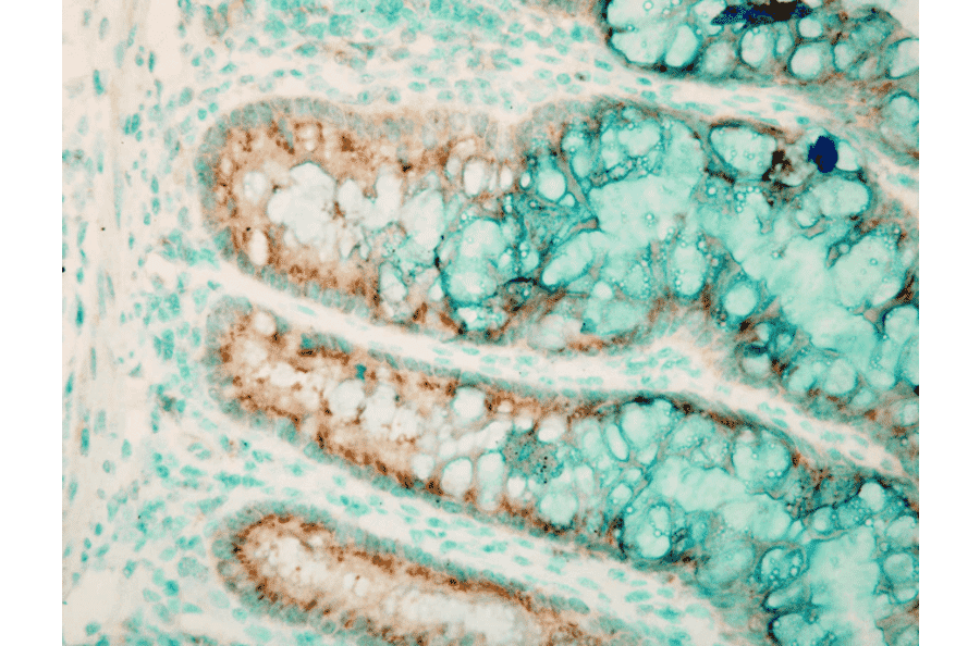 Immunohistochemistry - Anti-TLR4 Antibody (A304918) - Antibodies.com
