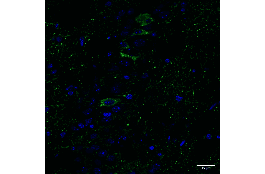 Immunohistochemistry - Anti-Tau (phospho Ser202 + Thr205) Antibody [AH36] (A304919) - Antibodies.com