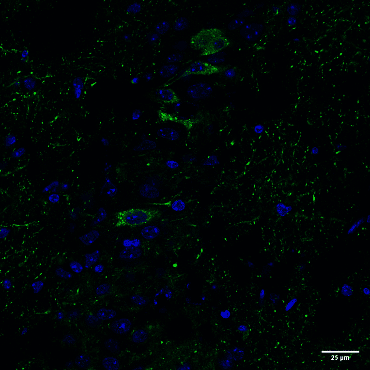 Immunohistochemistry - Anti-Tau (phospho Ser202 + Thr205) Antibody [AH36] (A304919) - Antibodies.com