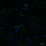 Immunohistochemistry - Anti-Tau (phospho Ser202 + Thr205) Antibody [AH36] (A304919) - Antibodies.com