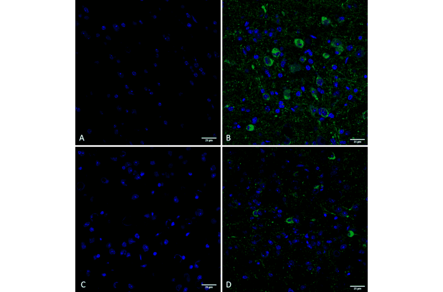 Immunohistochemistry - Anti-Tau (phospho Ser202 + Thr205) Antibody [AH36] (A304919) - Antibodies.com