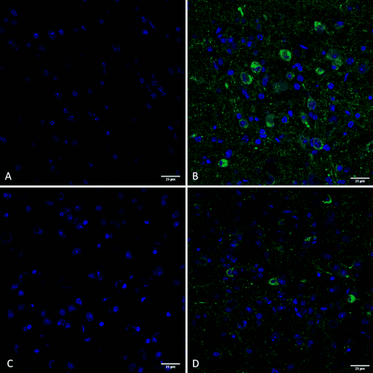 Immunohistochemistry - Anti-Tau (phospho Ser202 + Thr205) Antibody [AH36] (A304919) - Antibodies.com