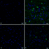 Immunohistochemistry - Anti-Tau (phospho Ser202 + Thr205) Antibody [AH36] (A304919) - Antibodies.com
