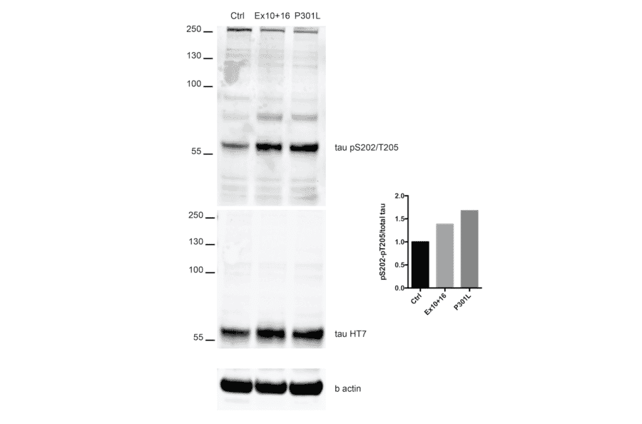 Western Blot - Anti-Tau (phospho Ser202 + Thr205) Antibody [AH36] (A304919) - Antibodies.com