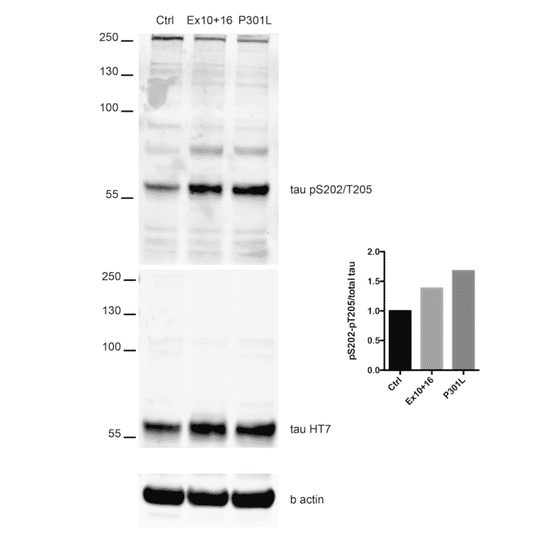 Western Blot - Anti-Tau (phospho Ser202 + Thr205) Antibody [AH36] (A304919) - Antibodies.com