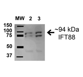 Western Blot - Anti-IFT88 Antibody (A304920) - Antibodies.com