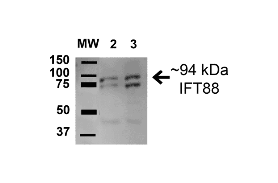 Western Blot - Anti-IFT88 Antibody (A304920) - Antibodies.com
