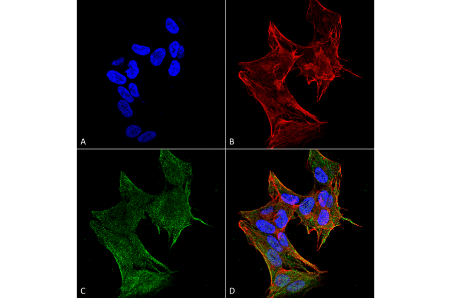 Immunocytochemistry/Immunofluorescence - Anti-IFT88 Antibody (A304920) - Antibodies.com