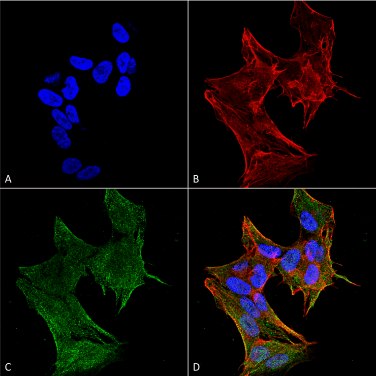 Immunocytochemistry/Immunofluorescence - Anti-IFT88 Antibody (A304920) - Antibodies.com