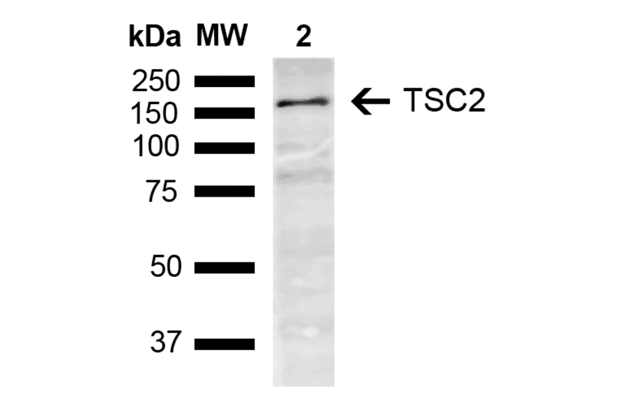 Western Blot - Anti-Tuberin Antibody (A304921) - Antibodies.com