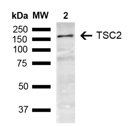 Western Blot - Anti-Tuberin Antibody (A304921) - Antibodies.com