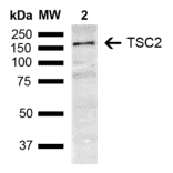 Western Blot - Anti-Tuberin Antibody (A304921) - Antibodies.com