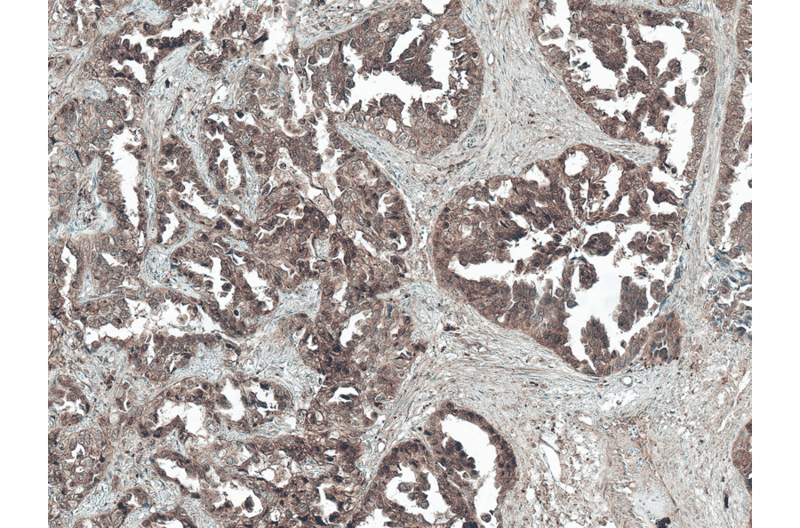 Immunohistochemistry - Anti-Tuberin Antibody (A304921) - Antibodies.com