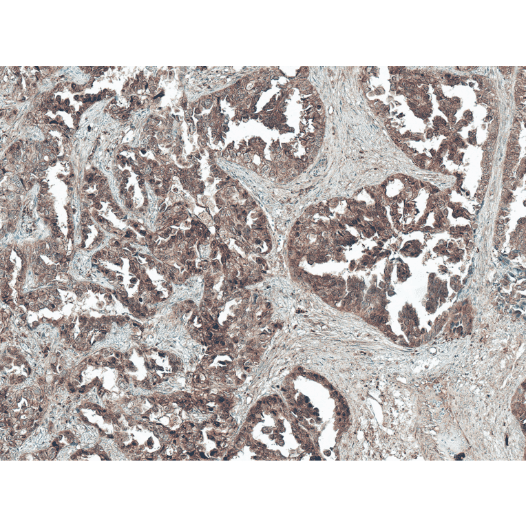 Immunohistochemistry - Anti-Tuberin Antibody (A304921) - Antibodies.com