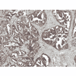 Immunohistochemistry - Anti-Tuberin Antibody (A304921) - Antibodies.com