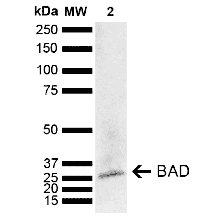 Western Blot - Anti-Bad Antibody (A304922) - Antibodies.com