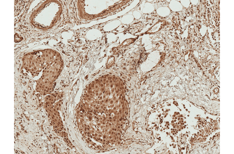 Immunohistochemistry - Anti-Bad Antibody (A304922) - Antibodies.com