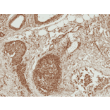 Immunohistochemistry - Anti-Bad Antibody (A304922) - Antibodies.com
