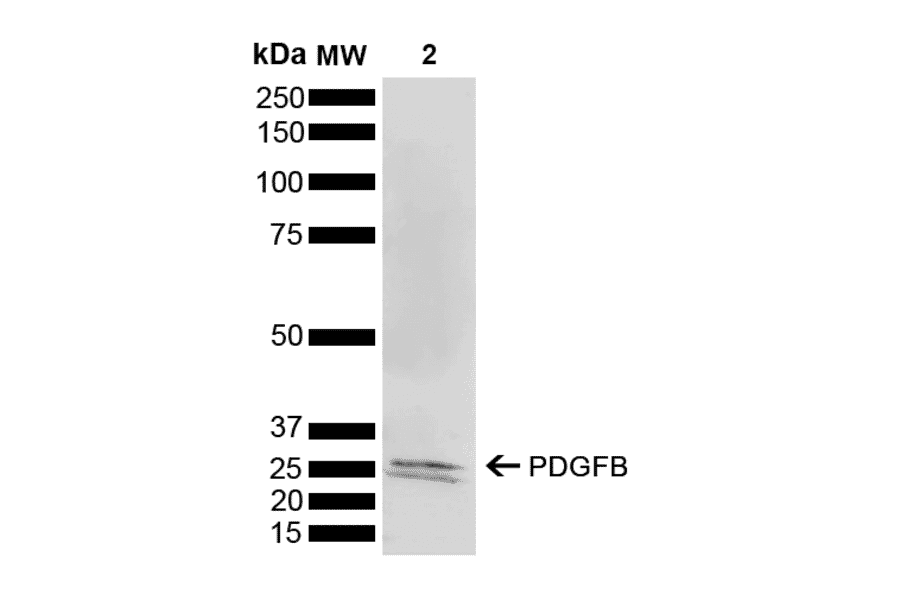Western Blot - Anti-PDGF B Antibody (A304924) - Antibodies.com