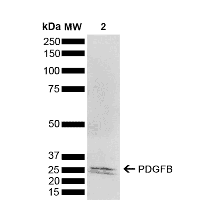 Western Blot - Anti-PDGF B Antibody (A304924) - Antibodies.com