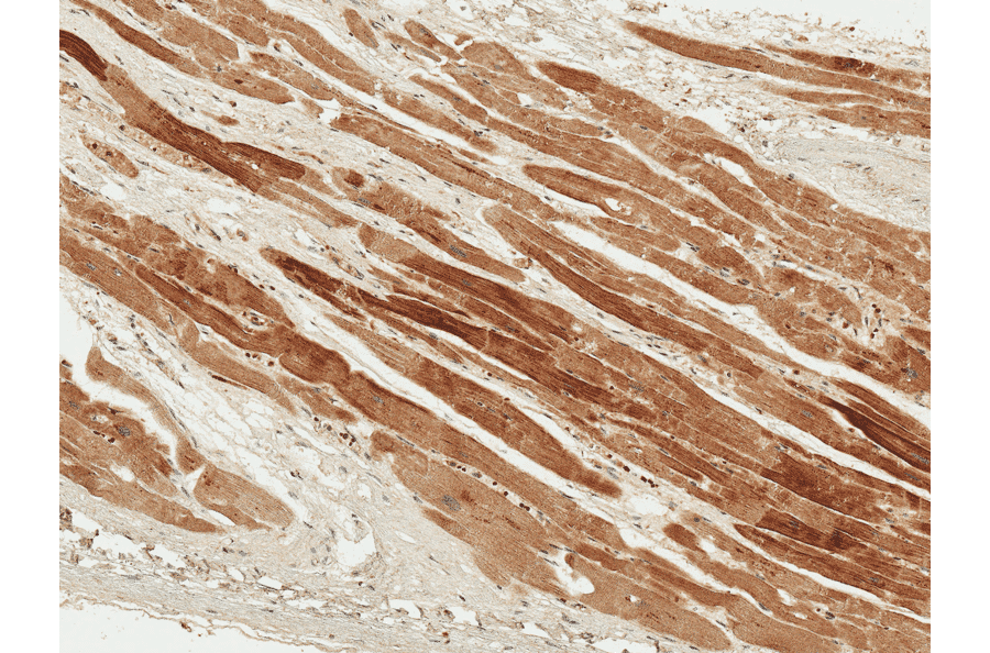 Immunohistochemistry - Anti-PDGF B Antibody (A304924) - Antibodies.com