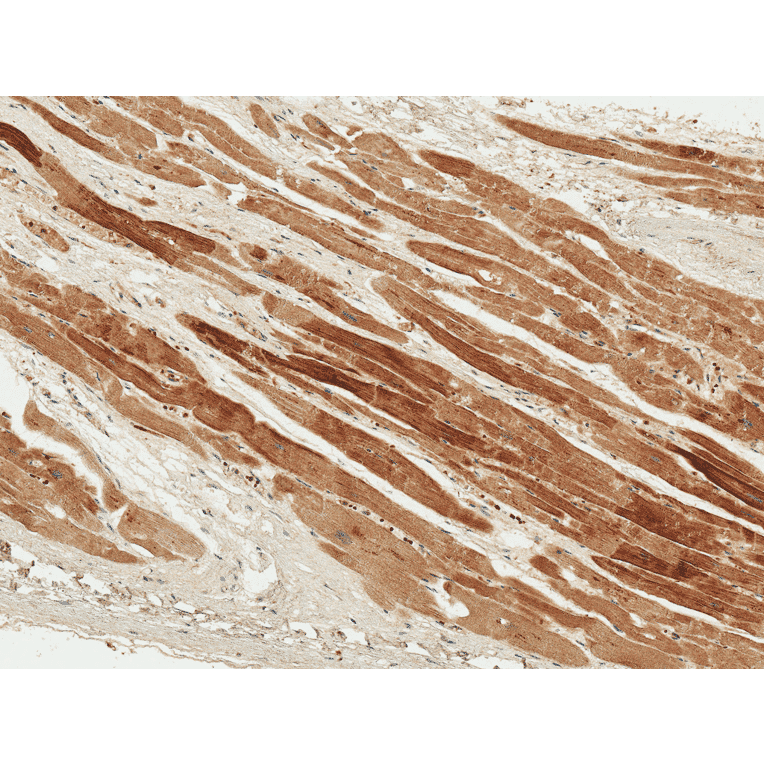 Immunohistochemistry - Anti-PDGF B Antibody (A304924) - Antibodies.com