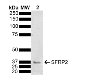 Western Blot - Anti-SFRP2 Antibody (A304925) - Antibodies.com