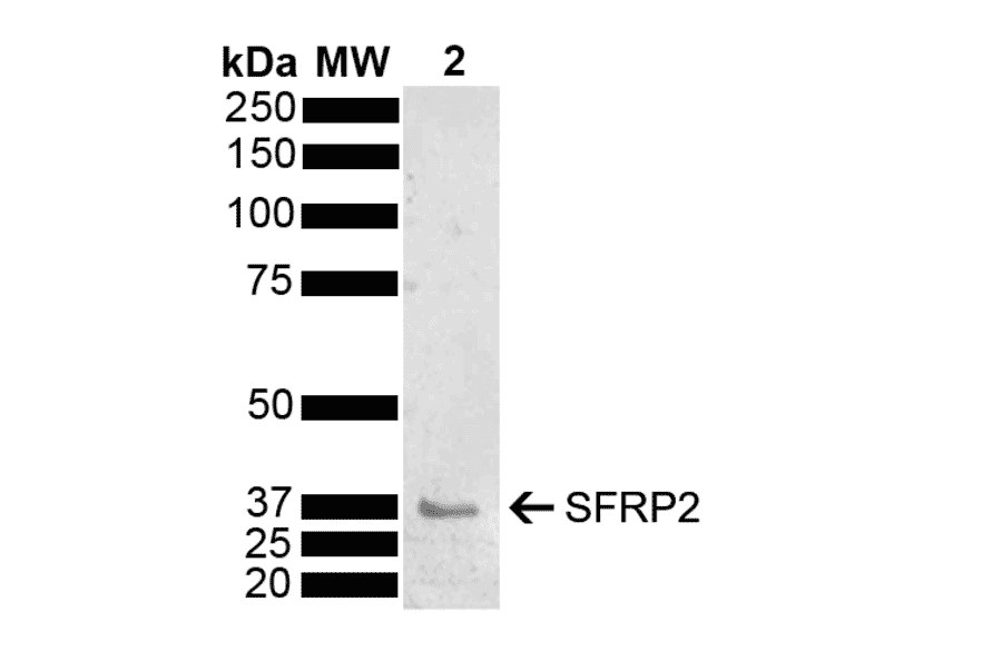 Western Blot - Anti-SFRP2 Antibody (A304925) - Antibodies.com