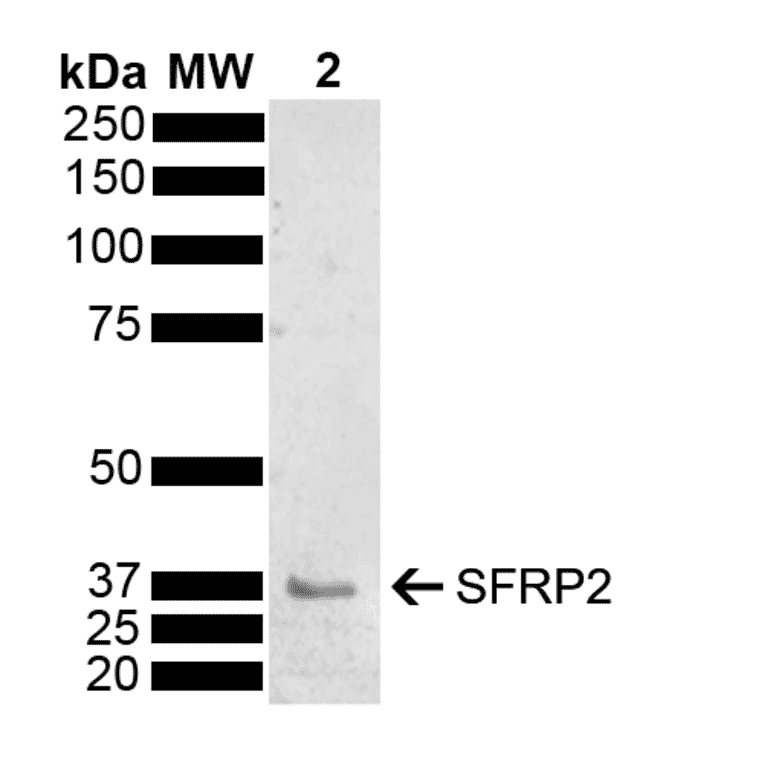 Western Blot - Anti-SFRP2 Antibody (A304925) - Antibodies.com