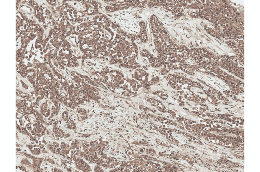 Immunohistochemistry - Anti-SFRP2 Antibody (A304925) - Antibodies.com